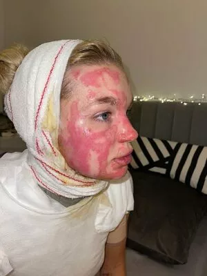 Abbie Quinnen OnlyFans Leaked Free Thumbnail Picture - #nbRuNkVYuz