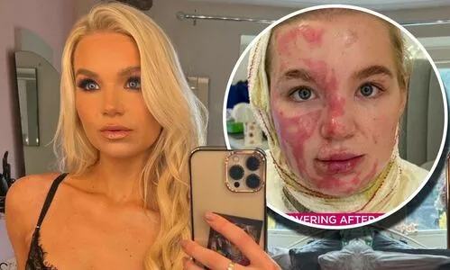 Abbie Quinnen OnlyFans Leaked Free Thumbnail Picture - #wfp70S6MqT