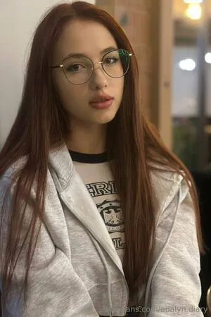 Adalyn Diary OnlyFans Leaked Free Thumbnail Picture - #PacqSofnPV