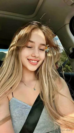 Adalyn Diary OnlyFans Leaked Free Thumbnail Picture - #jhtnmr9LUI
