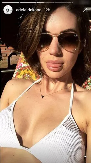 Adelaide Kane OnlyFans Leaked Free Thumbnail Picture - #JzJUnAKHnY