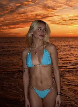 Adler Twins OnlyFans Leaked Free Thumbnail Picture - #yZVakK5wq4