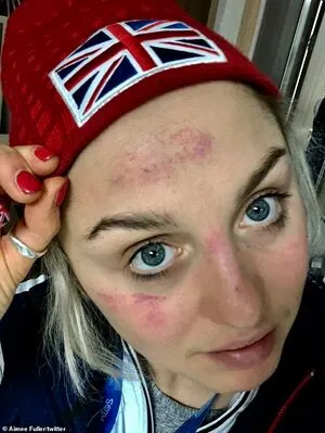 Aimee Fuller OnlyFans Leaked Free Thumbnail Picture - #c0niersvby