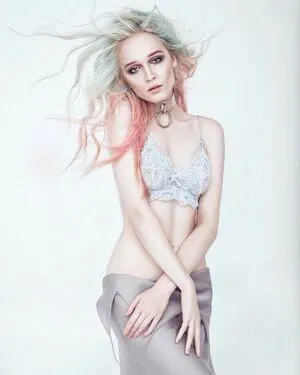 Albertaberlin OnlyFans Leaked Free Thumbnail Picture - #lKOU0FMEfV