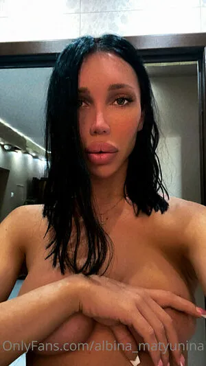 Albina Matyunina OnlyFans Leaked Free Thumbnail Picture - #c4ADAYfAqZ