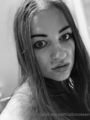 Albinoteen OnlyFans Leaked Free Thumbnail Picture - #9H1wCgaN5H