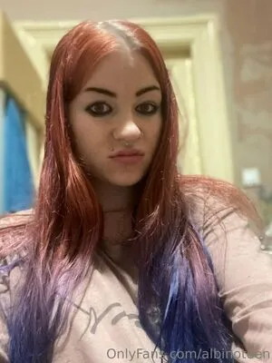 Albinoteen OnlyFans Leaked Free Thumbnail Picture - #IwjlDQ4njE