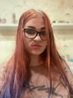 Albinoteen OnlyFans Leaked Free Thumbnail Picture - #NiDBCQTISD