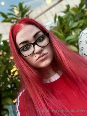 Albinoteen OnlyFans Leaked Free Thumbnail Picture - #c0YZtZFJY0