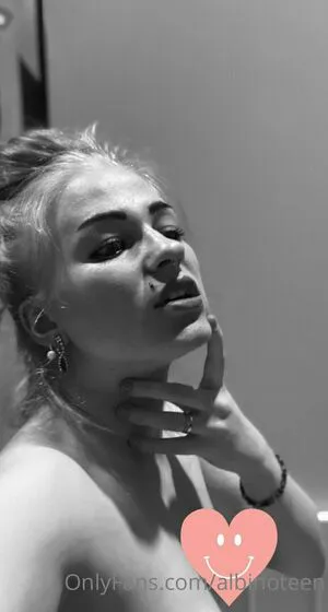 Albinoteen OnlyFans Leaked Free Thumbnail Picture - #i1p5XudiSo