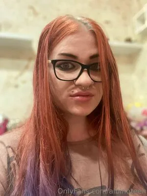 Albinoteen OnlyFans Leaked Free Thumbnail Picture - #yJ9SGuxjbx