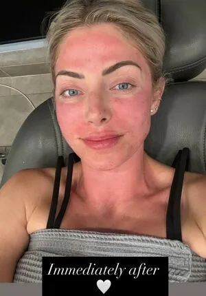 Alexa Bliss OnlyFans Leaked Free Thumbnail Picture - #Hbif7jYEax