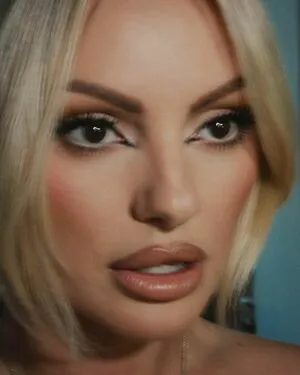 Alexandra Stan OnlyFans Leaked Free Thumbnail Picture - #8TRLyidwJS