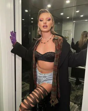 Alexandra Stan OnlyFans Leaked Free Thumbnail Picture - #wOm4h38CYd