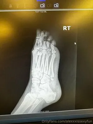 Alexxxissexyfun OnlyFans Leaked Free Thumbnail Picture - #HSBxe7ly2X