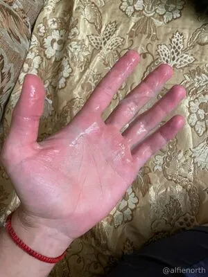 Alfienorthfree OnlyFans Leaked Free Thumbnail Picture - #s1BpHRRD8K