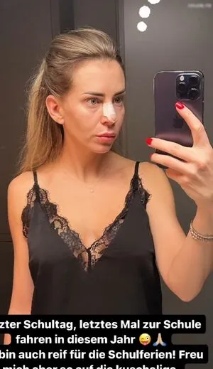 Alina Schulte Im Hoff OnlyFans Leaked Free Thumbnail Picture - #rwHnEwms8x