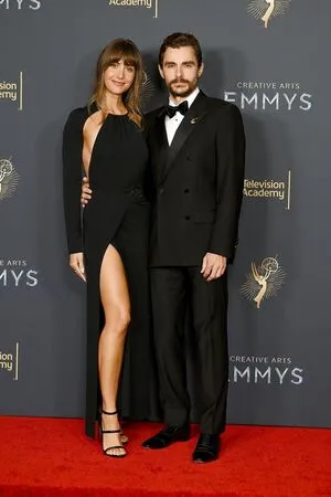 Alison Brie OnlyFans Leaked Free Thumbnail Picture - #Bi0wlscJIo