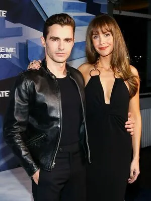 Alison Brie OnlyFans Leaked Free Thumbnail Picture - #GQwLKW7jbl