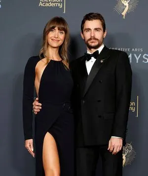 Alison Brie OnlyFans Leaked Free Thumbnail Picture - #vrxJHi0AzL