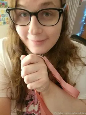 Allisonbites OnlyFans Leaked Free Thumbnail Picture - #pqVgEdQjTl