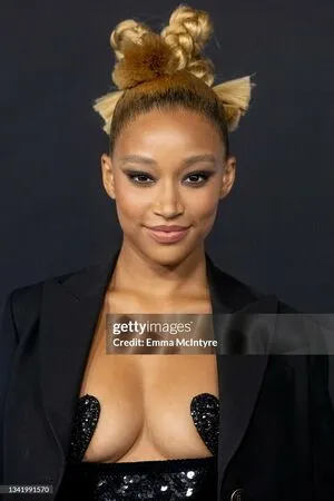 Amandla Stenberg OnlyFans Leaked Free Thumbnail Picture - #PNWgc3oyCl