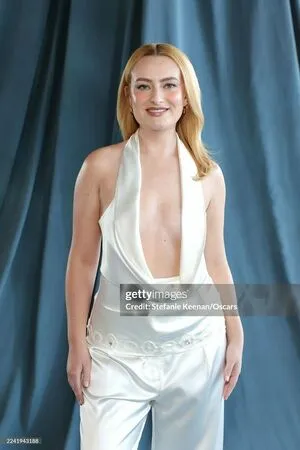 Amelia Dimoldenberg OnlyFans Leaked Free Thumbnail Picture - #wlz4RXzPmU