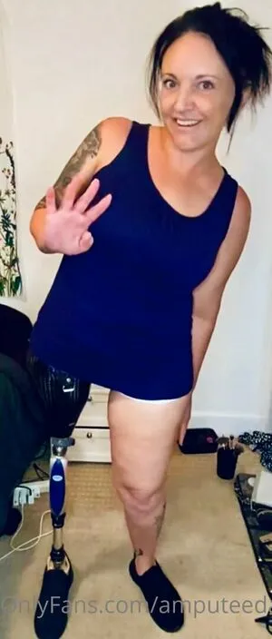 Amputeedarling OnlyFans Leaked Free Thumbnail Picture - #HhCZc1mvkU