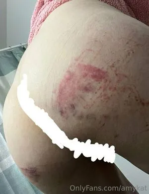 Amykat OnlyFans Leaked Free Thumbnail Picture - #tZwgi0lmTJ