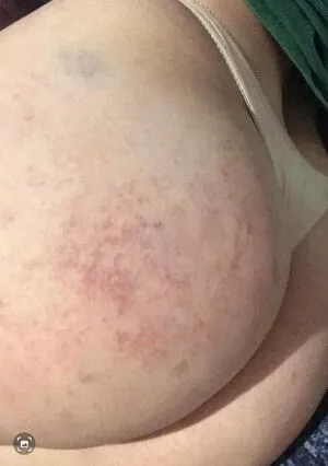 Ana Hr0vat OnlyFans Leaked Free Thumbnail Picture - #qpvG3GNIF4
