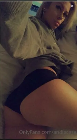 And1e C4se OnlyFans Leaked Free Thumbnail Picture - #RZeaP3Ui51