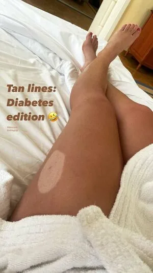 Anna Fernstdt OnlyFans Leaked Free Thumbnail Picture - #cBMLQsEREz