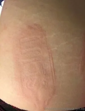 Anna Lyn Xo OnlyFans Leaked Free Thumbnail Picture - #Rgl4NUTPcb