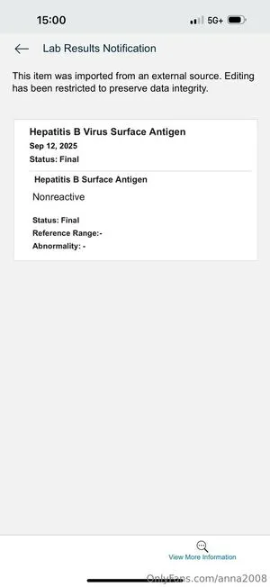 Anna2008 OnlyFans Leaked Free Thumbnail Picture - #uzbhs6nfR3