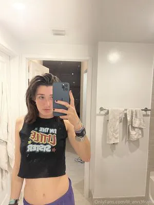Anne Frank OnlyFans Leaked Free Thumbnail Picture - #fj4Xtuse2J