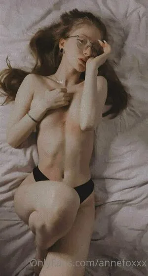 Annefoxxx OnlyFans Leaked Free Thumbnail Picture - #eRhQDA1oGJ