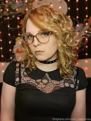 Anti Cistamines OnlyFans Leaked Free Thumbnail Picture - #262OpOs8n9