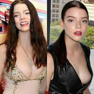 Anya Taylor-Joy OnlyFans Leaked Free Thumbnail Picture - #CNiqOnS5WT