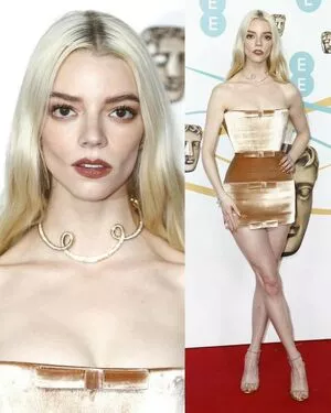 Anya Taylor-Joy OnlyFans Leaked Free Thumbnail Picture - #y2lX21Z8xH