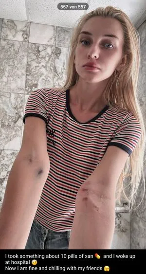 Aprikosin OnlyFans Leaked Free Thumbnail Picture - #NjsXLbdJuJ