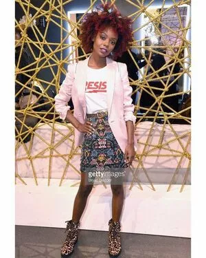 Ashleigh Murray OnlyFans Leaked Free Thumbnail Picture - #EuALerMi21