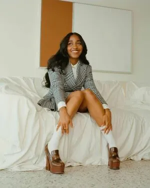 Ayo Edebiri OnlyFans Leaked Free Thumbnail Picture - #DkEwFFrMkx