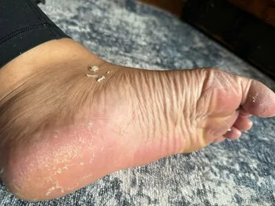 Azerasfeet OnlyFans Leaked Free Thumbnail Picture - #oudhXZtmzR