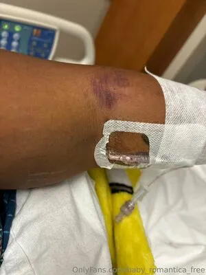 Baby Romantica Free OnlyFans Leaked Free Thumbnail Picture - #uWyr7pzFit