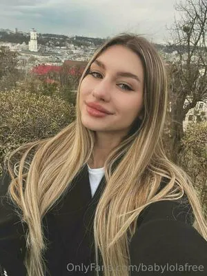 Babylolafree OnlyFans Leaked Free Thumbnail Picture - #1RhfsxYC5j