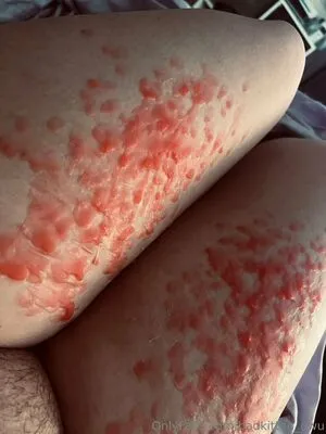 Badkitten Uwu OnlyFans Leaked Free Thumbnail Picture - #XxNtmZvarc