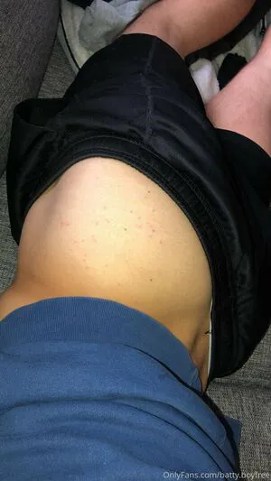 Battyboyfree OnlyFans Leaked Free Thumbnail Picture - #ISDhtMNERq