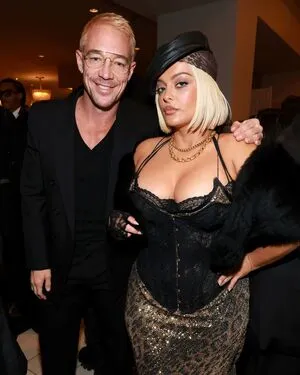 Bebe Rexha OnlyFans Leaked Free Thumbnail Picture - #sqygbmdaQC