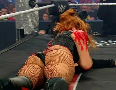 Becky Lynch OnlyFans Leaked Free Thumbnail Picture - #ShePl4aFdU