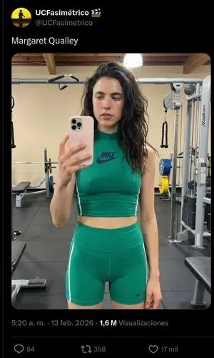 Billie Eilish OnlyFans Leaked Free Thumbnail Picture - #dwYg1ViYCN